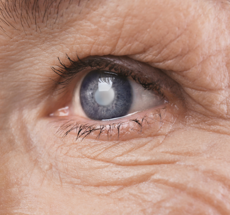 Close-up of senior eye during an examination